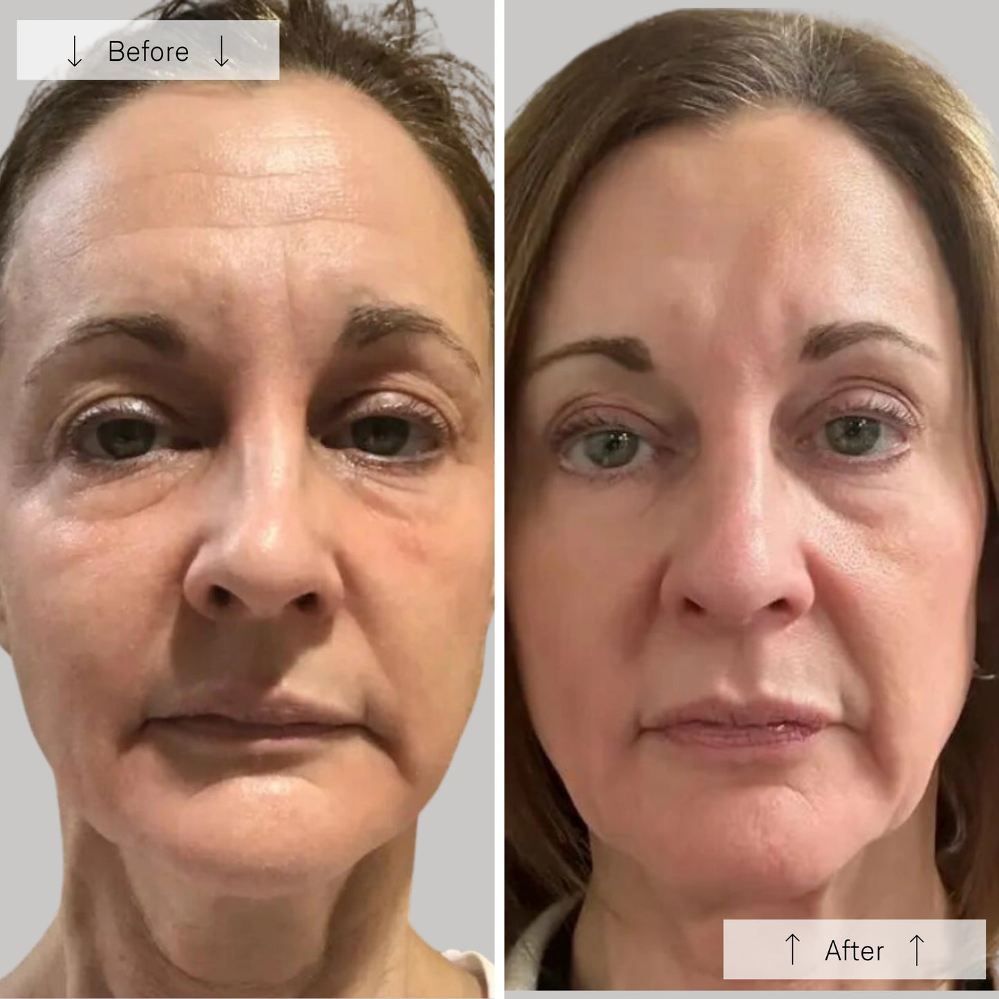 Omnilux Omnilux Contour Face
