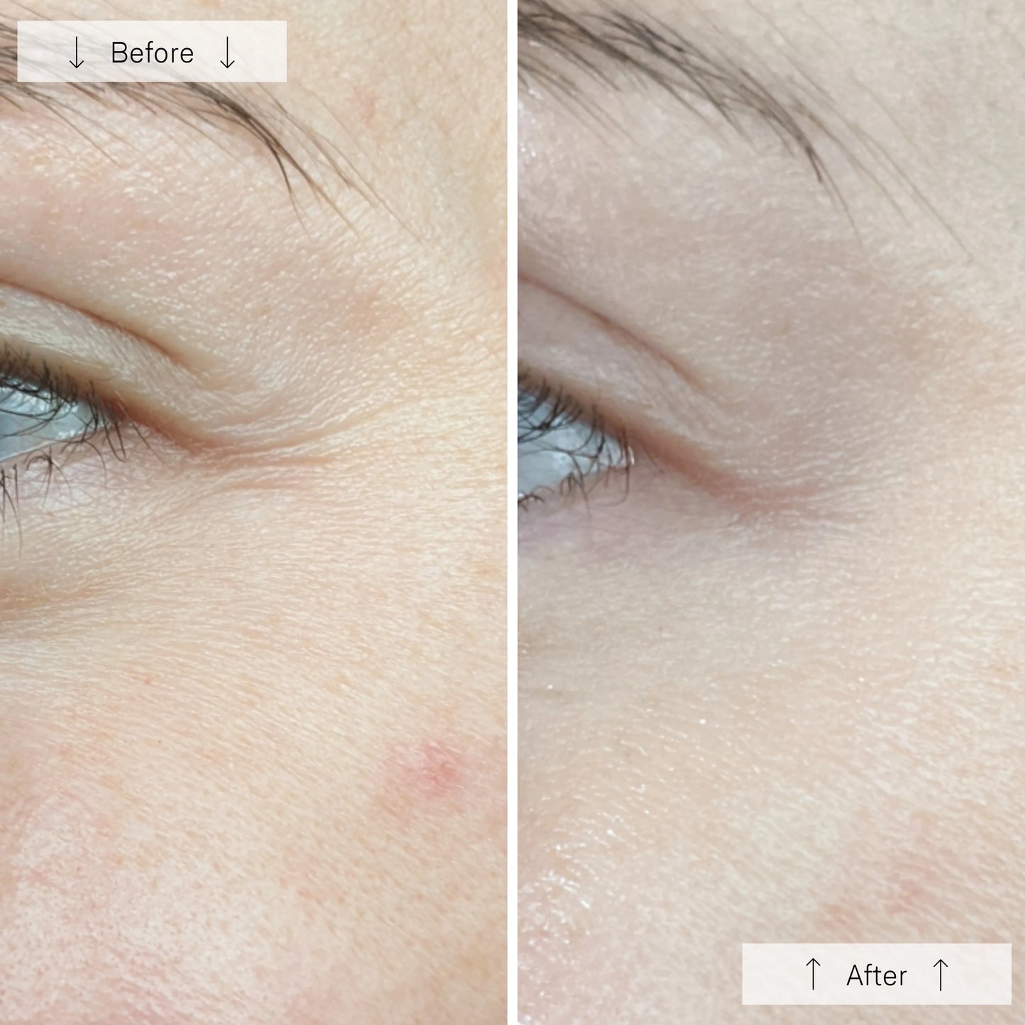 Omnilux Omnilux Contour Face