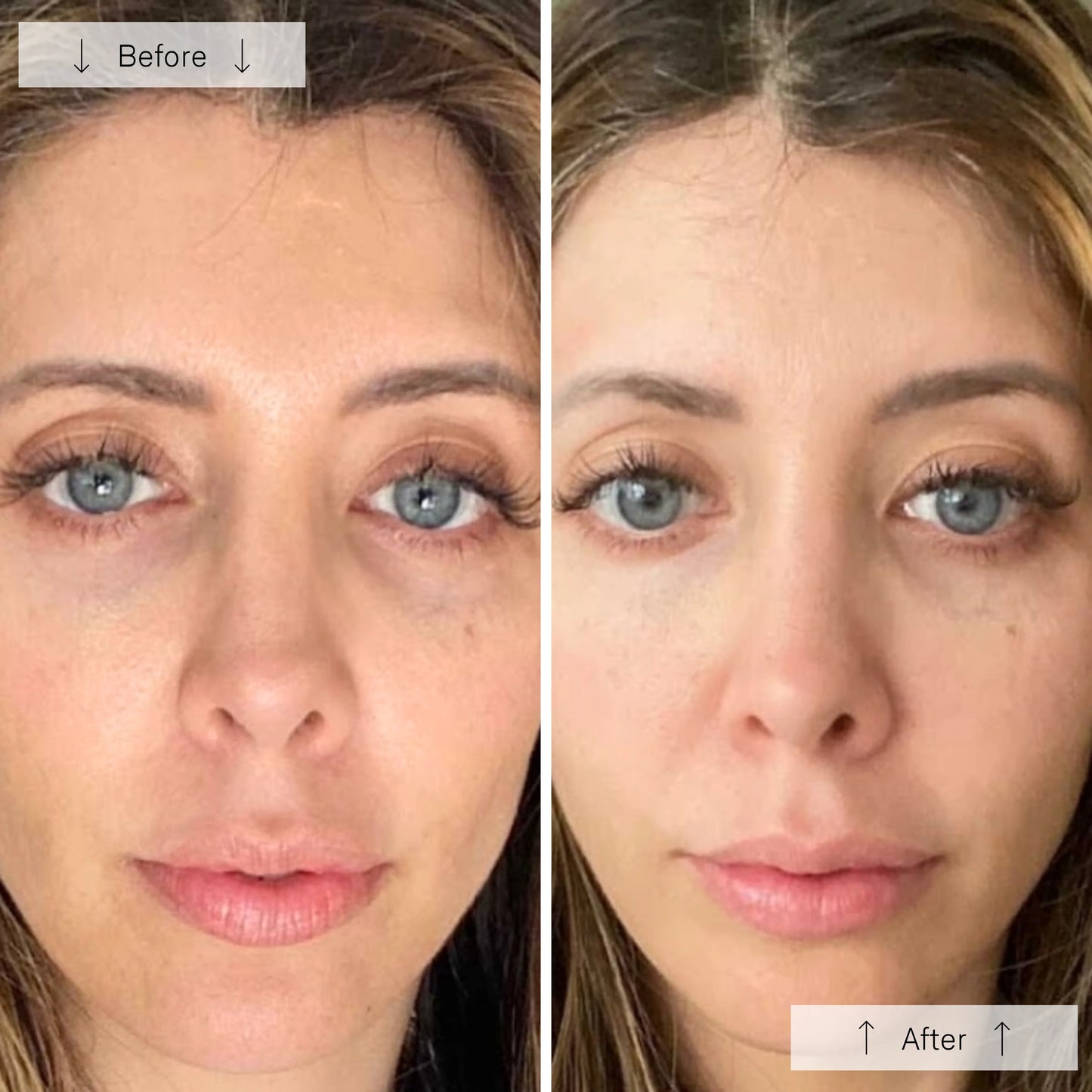 Omnilux Omnilux Contour Face