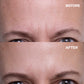Wrinkles Shminkles Wrinkles Schminkles Forehead Wrinkle Patches