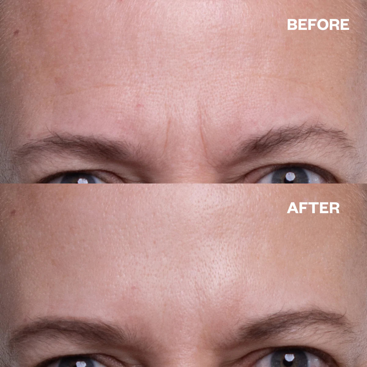 Wrinkles Shminkles Wrinkles Schminkles Forehead Wrinkle Patches