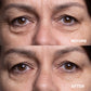 Wrinkles Shminkles Wrinkles Schminkles Eye Wrinkle Patches